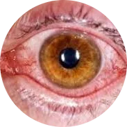 Eye Care & Vision